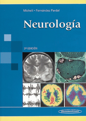 NEUROLOGIA